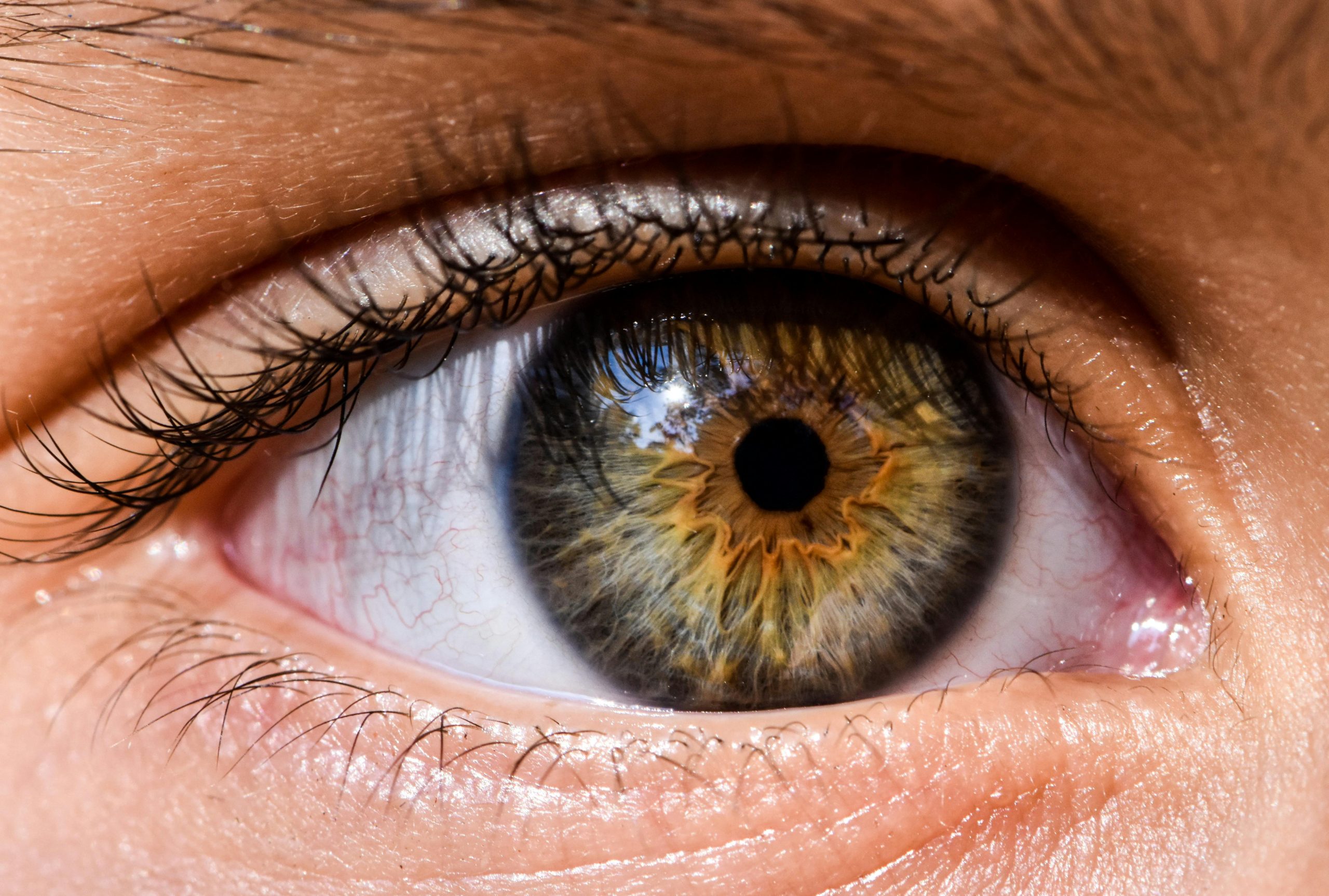 Understanding the Process: What Happens During Lasik Turkey Surgery